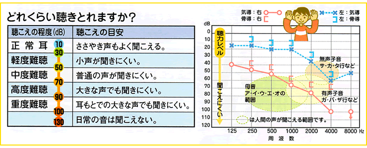 補聴器の装用効果